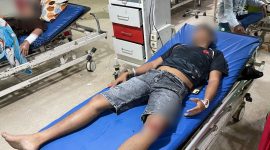 Dua anggota Polda Banten saat dirawat di RSDP Kabupaten Serang. (Dok)