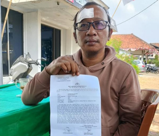 Korban dugaan pengeroyokan di kawasan Pasar Rau, Kota Serang, memperlihatkan dokumen laporan Dok : ( Ist/Total Banten)